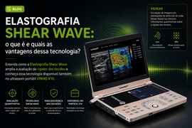 Elastografia Shear Wave: o que é e quando usar essa tecnologia?